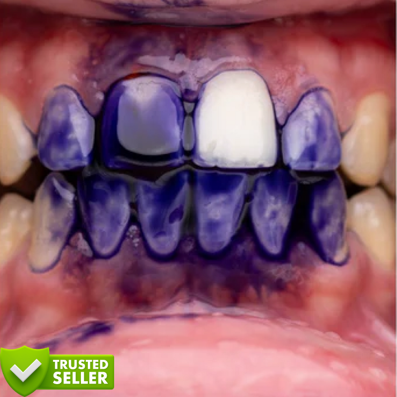 Purple V34™ | Weiße Zähne in nur 5 Minuten